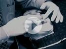 Video: Dentists on Invisalign