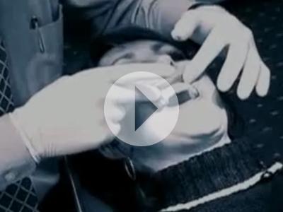 Video: Dentists on Invisalign