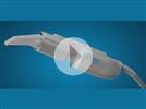 Video: iTero Digital Impressions- The Path To The Perfect Fit