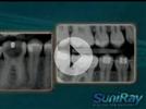 Video: SuniRay