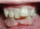 Webinar: Align Technology, Inc. - Why Do Invisalign: The Benefits and Opportunities