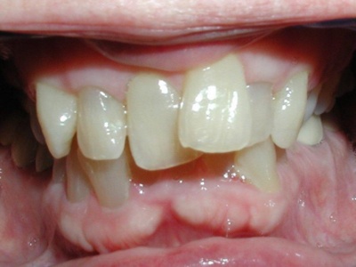 Webinar: Align Technology, Inc. - Why Do Invisalign: The Benefits and Opportunities