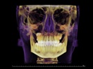 Product Overview: i-CAT for Orthodontics