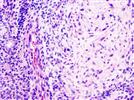Oral Cancer Screening – Doctors Better Get With The Program