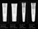 Restoring The Random Dental Implant