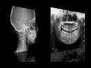 Video: Hyperion X7 Dental Digital Panoramic X-ray