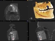 Oral Surgery Software