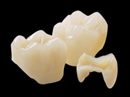 Lab Fabricated Indirect Restorations