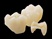 Lab Fabricated Indirect Restorations