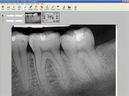 Dental Digital Radiography / X-ray