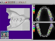 Orthodontic Software