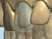 Chairside CAD/CAM Restorations (Dental CAD/CAM)