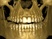 Dental Cone Beam Imaging  (Cone Beam 3D Imaging)