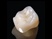 All Porcelain Ceramics