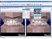 Orthodontic Digital Treament Planning Systems