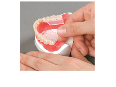 Step 1 - Place the mesial notch of Q3 Pack on the canine tooth and align it distally to the alveolar line.