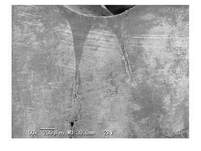 Flows deeply into pits or fissures achieving both chemical and mechanical retention.