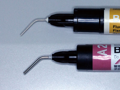 (Top BeautiSealant Tip, Bottom 19 gauge flowable tip) Ultra-fine 27 gauge needle tip provides precision placement, while preventing waste associated with dripping and overfilling.