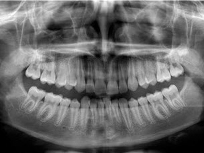 Versatile Software Tools to Enhance Diagnostic Capabilities