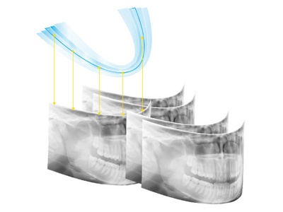 Multilayer Panoramic Option