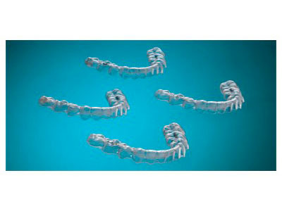 Convenient subscription program of four sets of retainers
