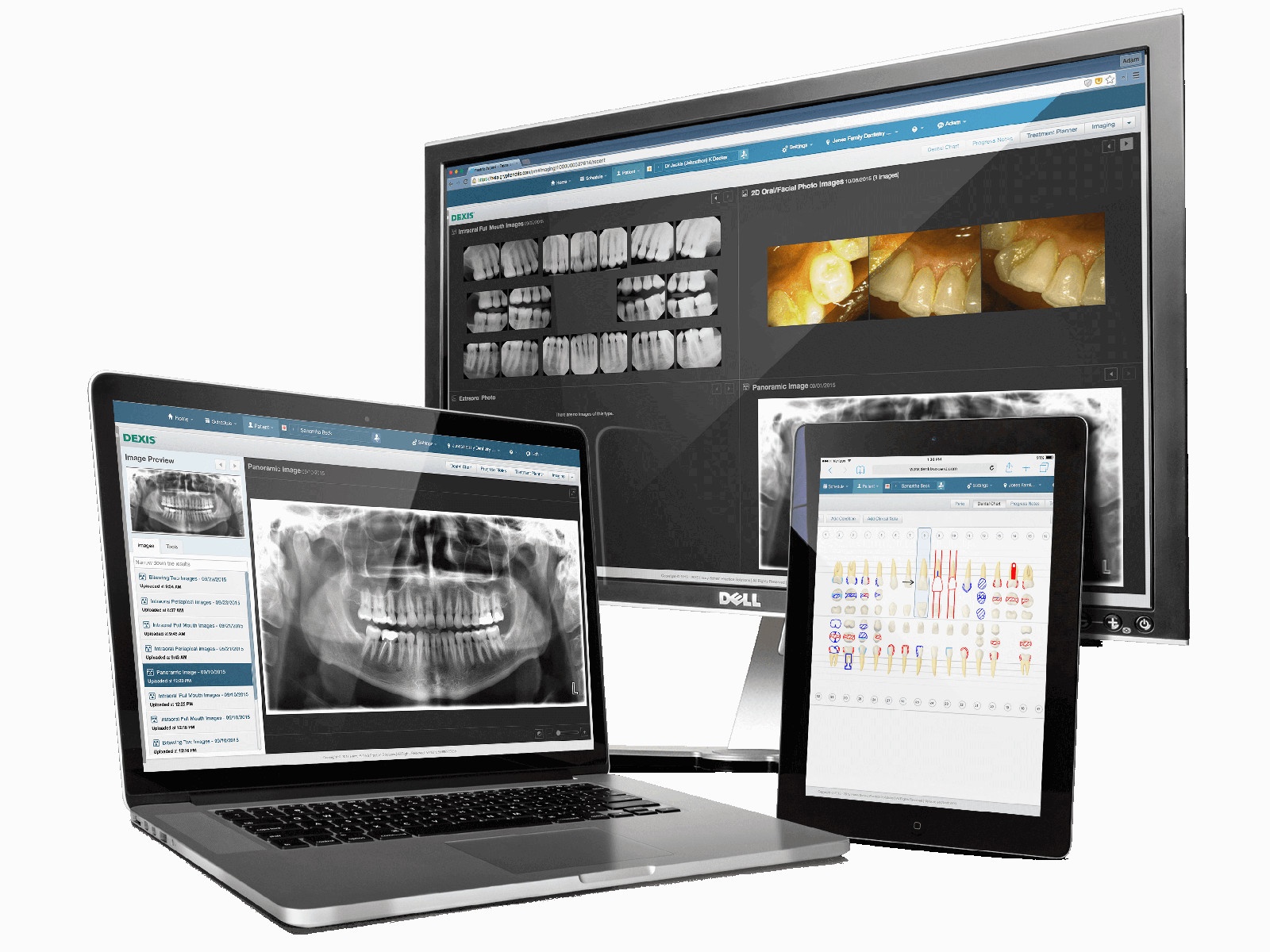 How Your Dental Practice Can Benefit from Cloud Imaging | Dentalcompare.com