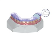 3Shape Ortho System Software Receives FDA Market Clearance for Additional Indications