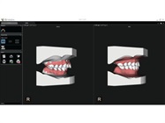 New Dental Products CS Model+ and the CS Airway software modules from Carestream Dental