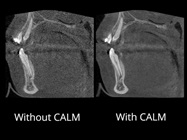 Enhanced Dental Product: Planmeca ProMax 3D Imaging System
