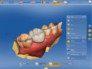 Enhanced Dental Product: CEREC Software 4.5 from Dentsply Sirona