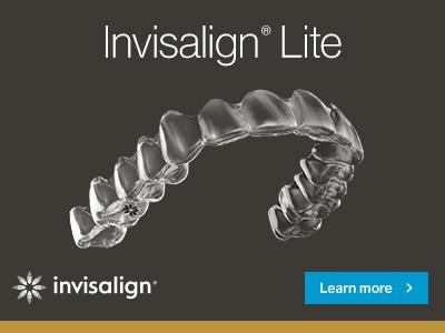 Give Express 10 patients more value with Invisalign® Lite