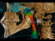 New Dental Product: CS Airway Module from Carestream Dental