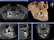 AAP Publishes First ‘Best Evidence Consensus’ Proceedings on CBCT