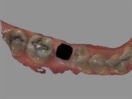 Enhanced Dental Product: CS 3600 Software from Carestream Dental