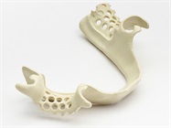 New Dental Product: Ultaire AKP from Solvay Dental 360