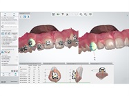 3M and 3Shape Form Partnership