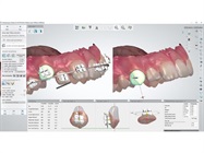 3Shape Receives FDA Clearance for Orthodontic Software