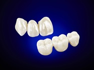 New Dental Product: Vericore ZR PRO Zirconia CAD/CAM Material from Whip Mix
