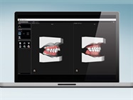 New Dental Product: CS Model+ Orthodontic Software from Carestream Dental