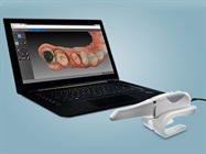 CS 3600 Intraoral Scanner Recognized for Performance in Finish Line Accuracy