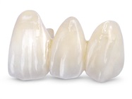 New Dental Product: BruxZir Esthetic Solid Zirconia from Glidewell Dental