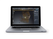 New Dental Product: SICAT Endo 3D Software from Dentsply Sirona