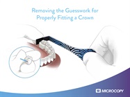 Free eBook: <br/>Microcopy’s New Solution to Seating a Crown