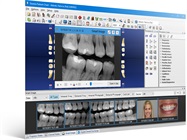 Enhanced Dental Product: Dentrix G7 Practice Management Software from Henry Schein One