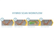 Enhanced Dental Product: CS 3600 Intraoral Scanner Hybrid Scan from Carestream Dental