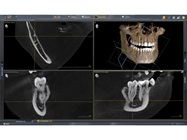 Enhanced Dental Products: Sidexis 4 V 4.3 Imaging Software and Orthophos SL from Dentsply Sirona