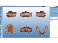 Enhanced Dental Products: Planmeca PlanMill 30 S, Planmeca Romexis 5.2, Planmeca PlanCAD 6.0.5 and Planmeca Emerald Slim Line Scanning Tip