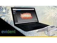 New Dental Product: Evident IOS Service featuring the Carestream Dental CS 3600 Intraoral Scanner