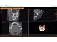 3D Module for XVWeb Cloud Imaging Service from LED Apteryx Earns FDA Approval