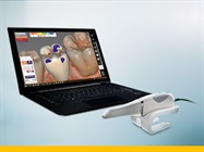 Enhanced Dental Product: CS 3600 Intraoral Scanner from Carestream Dental Adds exocad Integration